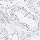 Immunohistochemical staining of human testis shows no positivity in cells in seminiferous ducts.