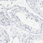 Immunohistochemical staining of human testis shows no positivity in cells in seminiferous ducts.