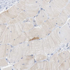 Immunohistochemical staining of human skeletal muscle shows no positivity in myocytes.