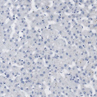 Anti-STMN3 Antibody