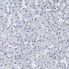 Immunohistochemical staining of human liver shows no positivity in hepatocytes.