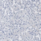 Immunohistochemical staining of human liver shows no positivity in hepatocytes.
