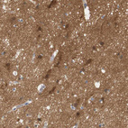 Immunohistochemical staining of human cerebral cortex shows moderate to strong cytoplasmic positivity in neurons.