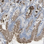 Anti-MYEOV Antibody