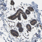 Immunohistochemical staining of human breast shows moderate cytoplasmic positivity in glandular cells.