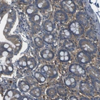 Immunohistochemical staining of human duodenum shows weak cytoplasmic positivity in glandular cells.