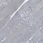 Immunohistochemical staining of human skeletal muscle shows no positivity in myocytes as expected.