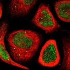 Immunofluorescent staining of human cell line A-431 shows localization to nucleus & vesicles.