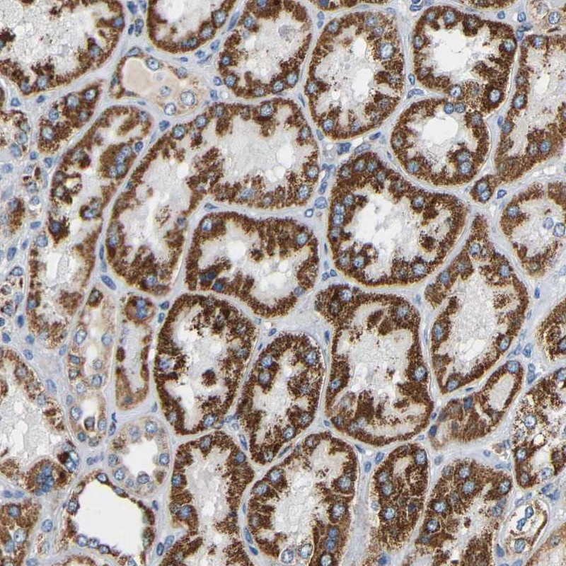 Anti-GALNT18 Antibody