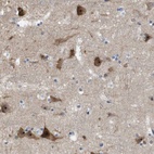 Anti-PNMAL1 Antibody