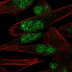 Immunofluorescent staining of human cell line RH-30 shows localization to nucleoplasm & nuclear bodies.