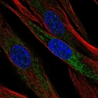 Immunofluorescent staining of human cell line ASC TERT1 shows localization to endoplasmic reticulum.