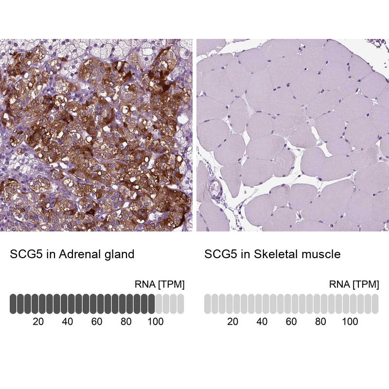 Anti-SCG5 Antibody