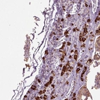 Immunohistochemical staining of human pituitary gland shows strong cytoplasmic positivity in endocrine glandular cells.