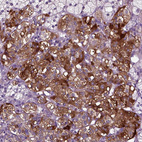 Immunohistochemical staining of human adrenal gland shows strong cytoplasmic positivity in endocrine glandular cells.