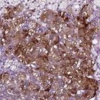 Immunohistochemical staining of human adrenal gland shows strong cytoplasmic positivity in endocrine glandular cells.