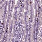 Immunohistochemical staining of human duodenum shows strong cytoplasmic positivity in enteroendocrine cells.