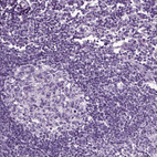 Immunohistochemical staining of human lymph node shows no positivity in germinal center cells and non-germinal center cells as expected.
