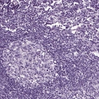 Immunohistochemical staining of human lymph node shows no positivity in germinal center cells and non-germinal center cells as expected.
