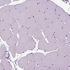 Immunohistochemical staining of human skeletal muscle shows no cytoplasmic positivity in myocytes as expected.