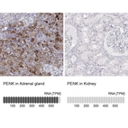 Anti-PENK Antibody