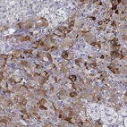 Immunohistochemical staining of human adrenal gland shows high expression.