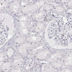 Immunohistochemical staining of human kidney shows low expression as expected.