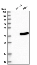 Western blot analysis in control (vector only transfected HEK293T lysate) and PENK over-expression lysate (Co-expressed with a C-terminal myc-DDK tag (~3.1 kDa) in mammalian HEK293T cells, LY401880).