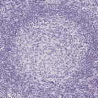 Immunohistochemical staining of human lymph node shows no positivity in germinal center cells as expected.