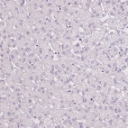 Immunohistochemical staining of human liver shows no positivity in hepatocytes as expected.
