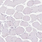 Immunohistochemical staining of human skeletal muscle shows no positivity in myocytes as expected.