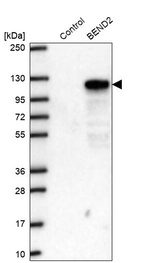 Western blot analysis in control (vector only transfected HEK293T lysate) and BEND2 over-expression lysate (Co-expressed with a C-terminal myc-DDK tag (~3.1 kDa) in mammalian HEK293T cells, LY407063).