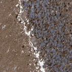 Immunohistochemical staining of human cerebellum shows strong cytoplasmic positivity in cells in granular layer.