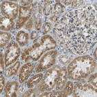 Immunohistochemical staining of human kidney shows moderate cytoplasmic positivity in cells in tubules.