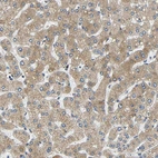 Immunohistochemical staining of human liver shows moderate cytoplasmic positivity in hepatocytes.