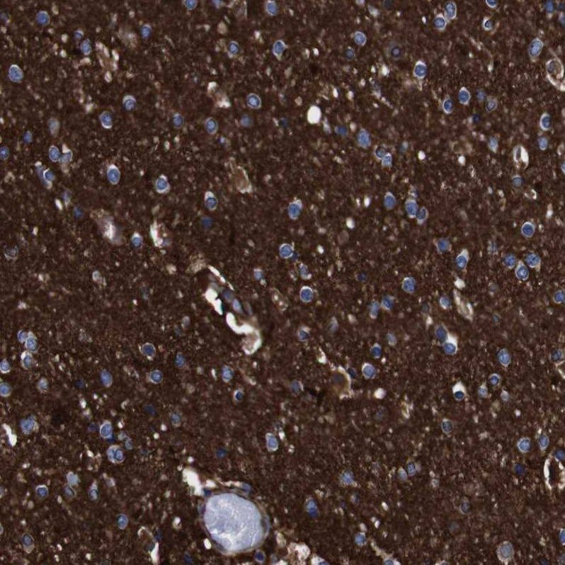 Anti-SPTBN1 Antibody