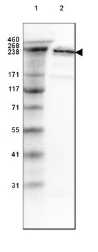 Anti-SPTBN1 Antibody