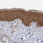 Anti-IL11RA Antibody