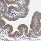 Immunohistochemical staining of human Fallopian tube shows weak to moderate cytoplasmic and membranous positivity in glandular cells.
