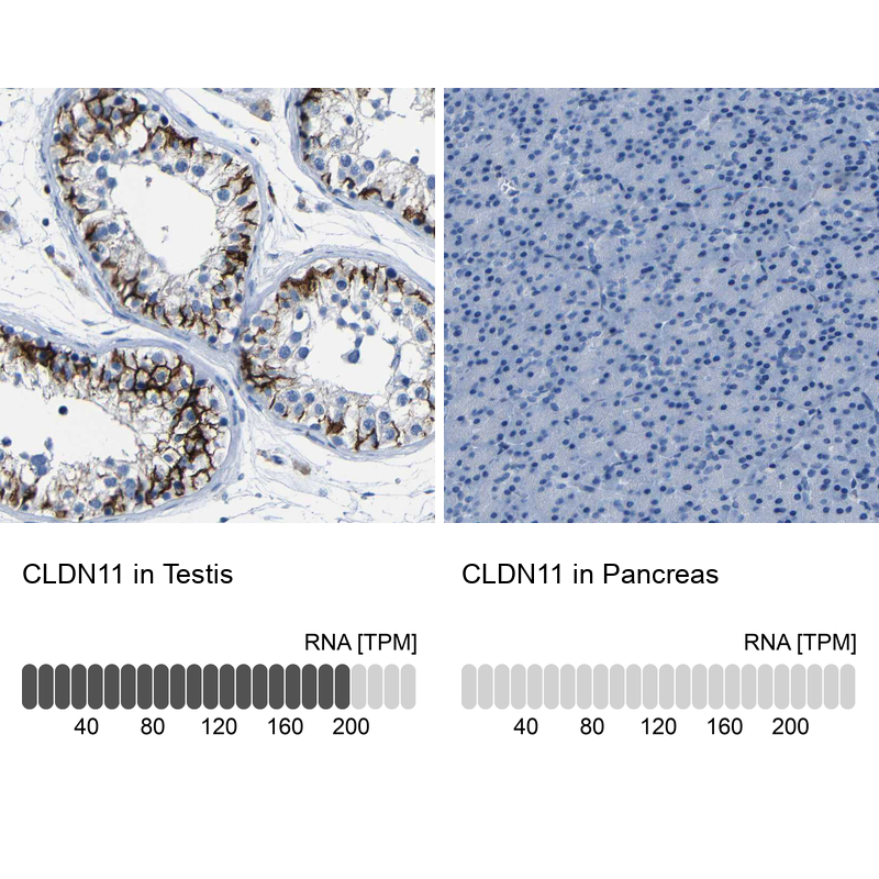 Anti-CLDN11 Antibody
