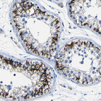 Anti-CLDN11 Antibody