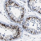 Immunohistochemical staining of human Testis shows strong membranous positivity in cells in seminiferous ducts.