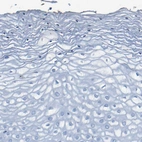 Immunohistochemical staining of human Cervix shows no positivity in squamous epithelial cells as expected.