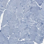 Immunohistochemical staining of human Skeletal muscle shows no positivity in myocytes as expected.