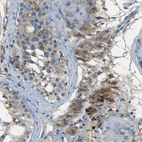 Anti-NETO2 Antibody