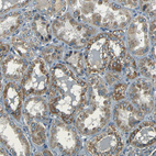 Immunohistochemical staining of human kidney shows moderate granular cytoplasmic positivity in cells in tubules.