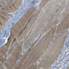Immunohistochemical staining of human skeletal muscle shows moderate cytoplasmic positivity in myocytes.