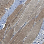 Immunohistochemical staining of human skeletal muscle shows moderate cytoplasmic positivity in myocytes.