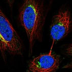 Immunofluorescent staining of human cell line SiHa shows localization to the Golgi apparatus.
