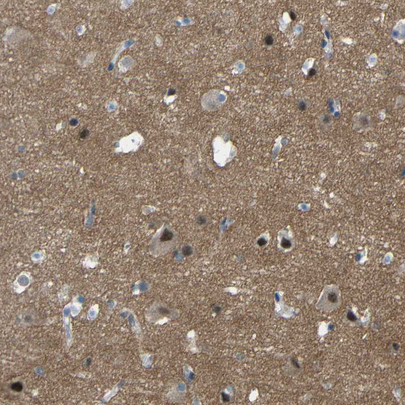 Anti-GPR158 Antibody